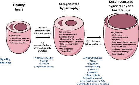 Pathological hypertrophy heart diagram - feryresume