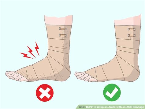 3 Easy Ways to Wrap an Ankle with an ACE Bandage - wikiHow