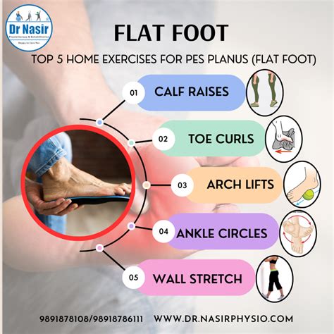 Flat Feet Treatment in Delhi | 9891878108 Dr Nasir Physiotherapy