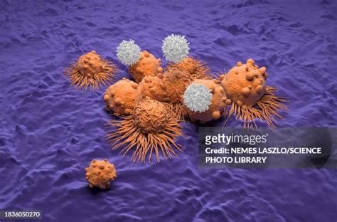 Kidney Cancer Cells Photos and Premium High Res Pictures - Getty Images