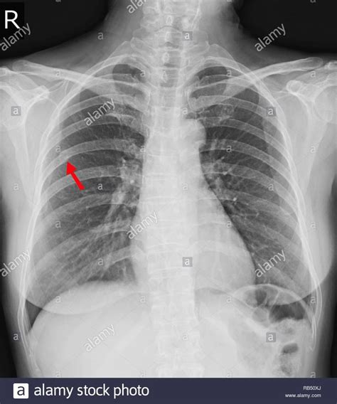 Pin on USMLE Step 1