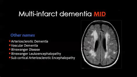 Pin de Jae Jones em Chronic illness | Radiologia, Anatomia, Lombar