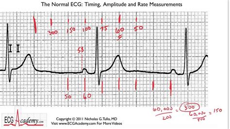 How To Count Ekg Strip