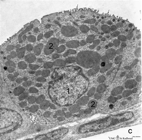 Clara cell in lung (gerbil) | Eccles Health Sciences Library | J. Willard Marriott Digital Library