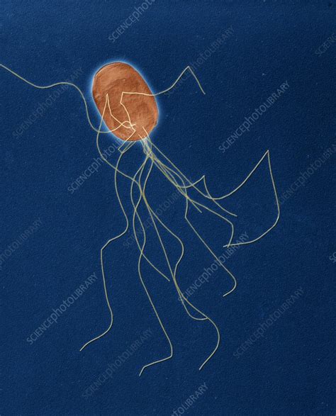 Proteus bacterium, SEM - Stock Image - C020/8730 - Science Photo Library