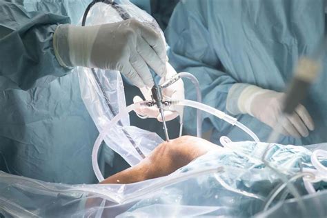 Are Orthopaedic Procedures Effective?