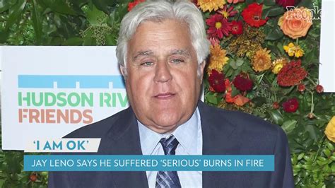 Jay Leno Says He Suffered 'Serious' Burns After Being Involved in Gasoline Fire: 'I Am OK'