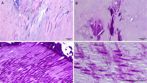 PAS staining. A H&E staining of carious dentin showing microorganisms... | Download Scientific ...