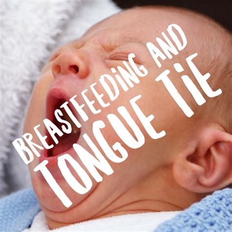 The Breastest News: Breastfeeding Guest Post: Breastfeeding and Tongue Tie