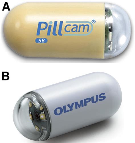 Capsule Endoscopy and Deep Enteroscopy: Indications for the Practicing ...