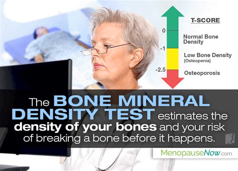 Bone Density Results: T Score & Z Score | Menopause Now