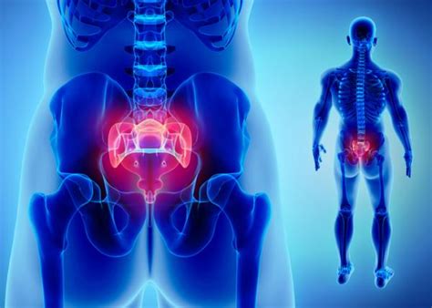 Coccyx Fracture: Aftermath And Consequences – From Doctor