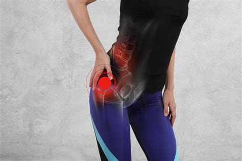 Gluteal Tendinopathy Treatment - Thrive Physio Plus