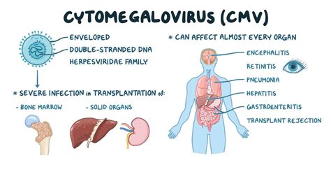 Congenital Cytomegalovirus (NORD): Video Anatomy Osmosis, 42% OFF