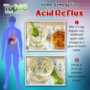 Home Remedies for Acid Reflux & GERD | Top 10 Home Remedies