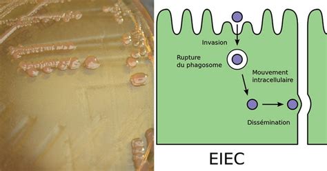 Enteroinvasive E. coli (EIEC)