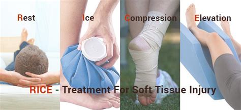 RICE - Treatment for Soft Tissue Injury | Sehat.com