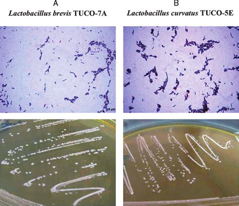 Lactobacillus Colony Morphology