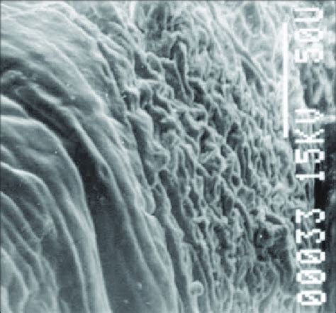 SEM photograph of the body morphology of Neoechinorhynchus sp. Figure... | Download Scientific ...