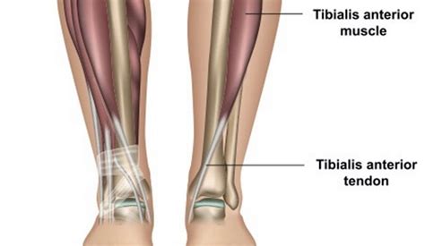 tibialis anterior tendonitis Archives - Sport Doctor London