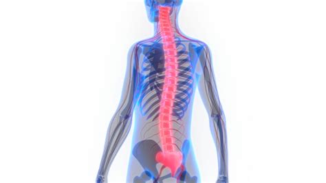 Spinal Shock: Causes, Symptoms, Diagnosis & Treatment - HealthPulls