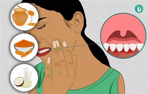 Home remedies for bleeding gums: what to use and how