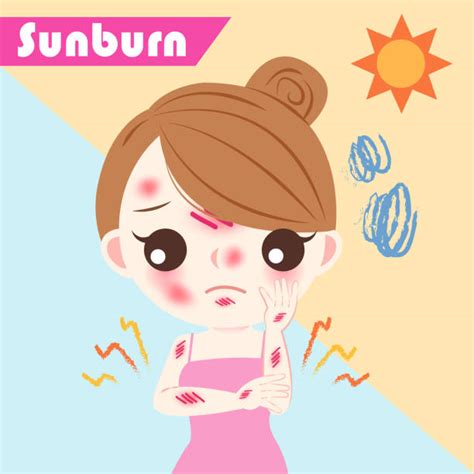 Royalty Free Sunburn Funny Clip Art, Vector Images & Illustrations - iStock