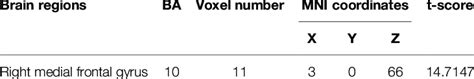 Interactive effect of MDD and gene on regional brain ALFF values ...