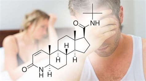 Finasteride side effects: what are they? - Insalaco Clinic