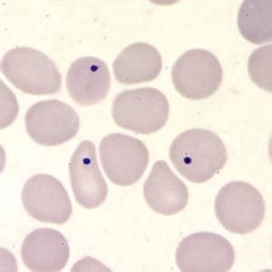 Howell-Jolly bodies in a thin blood smear stained with Giemsa | Medical Laboratories