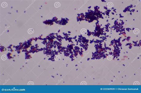 Gram Positive Cocci Royalty-Free Stock Photography | CartoonDealer.com #65597789