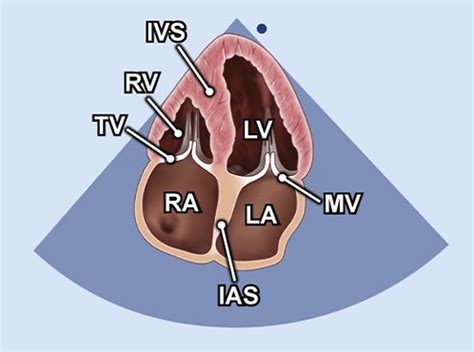 41 echocardiography views (Images & Videos) - TECHmED