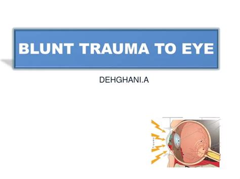 PPT - BLUNT TRAUMA TO EYE PowerPoint Presentation - ID:2759130