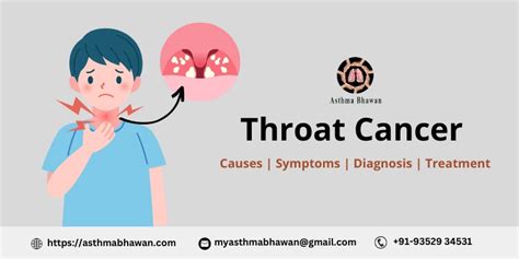 Throat Cancer - Causes, Symptoms, Diagnosis, and Treatment