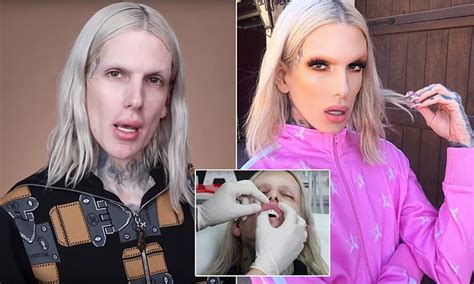 Jeffree Star Before And After