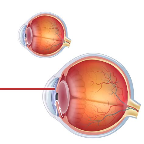 Dr Pritpal Singh - Ophthalmologist - Ophthalmic Surgery - Laser ...