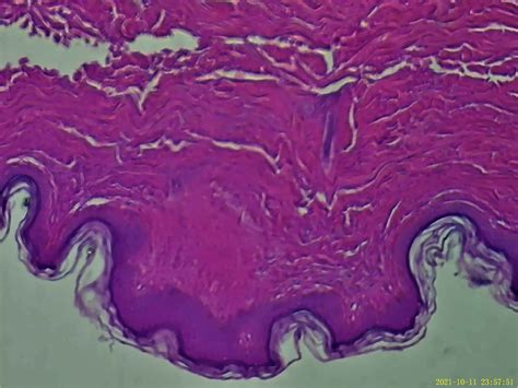 [Solved] Please help me label - the stratum corneum, stratum lucidum,... | Course Hero