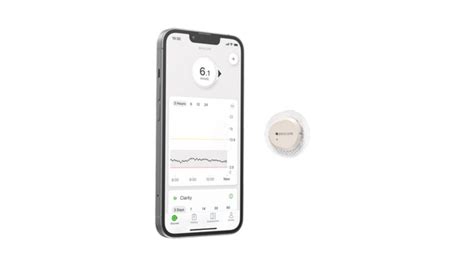 UK Dexcom CGM Comparison: How to Choose | Dexcom