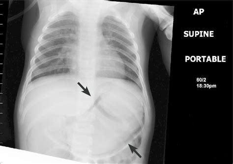 Supine Abdomen X Ray Anatomy