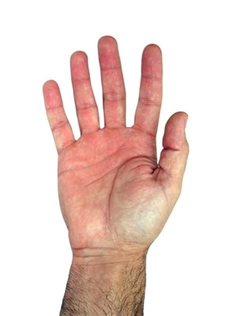 What Are the Symptoms of Nerve Damage in the Wrist? | Livestrong.com