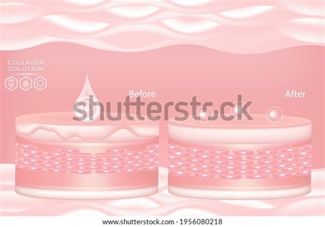 Hyaluronic Acid Before After Skin Solutions Stock Vector (Royalty Free) 1956080218 | Shutterstock