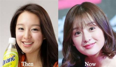 Kim Ji Won Plastic Surgery Before and After Photos - Latest Plastic ...