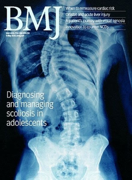 Download British Medical Journal (BMJ) – 4 May 2013 - PDF Magazine