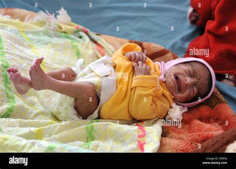 Malnourished children hi-res stock photography and images - Alamy