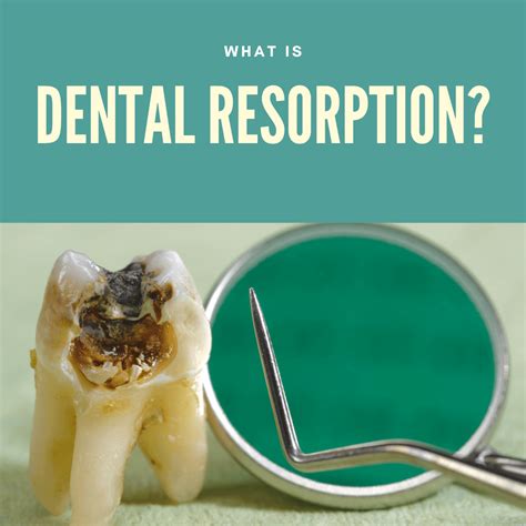 What is Dental Resorption?