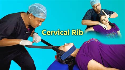 EFFECTIVE CERVICAL RIB Treatment |Expert Tips and Techniques| # ...