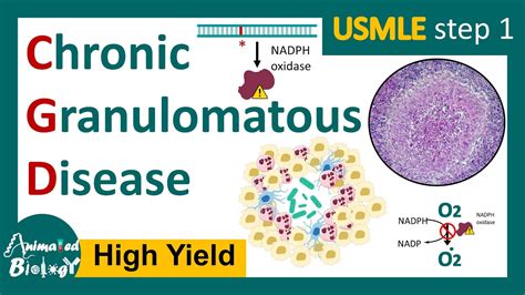 Chronic Granulomatous Disease: Symptoms and Causes