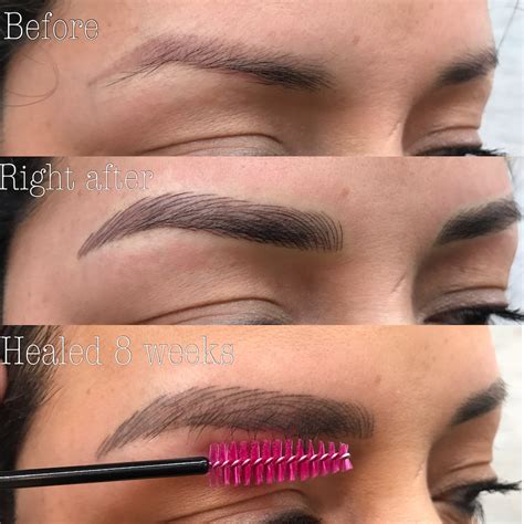 29+ Laser Eyebrow Tattoo Removal Before And After Pics | Eyebrow Ideas