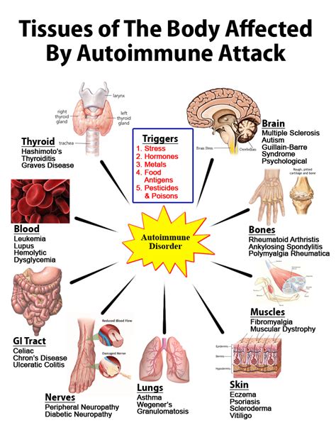 Autoimmune Disorders | Livers With Life