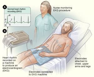 Ecocardiograma vs ECG: ¿Cuál es la diferencia'? | Mark's Trackside